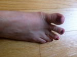 Picture B: Toe Wave